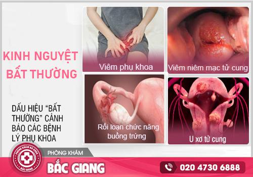 Khi kinh nguyệt bất thường cảnh báo điều gì?